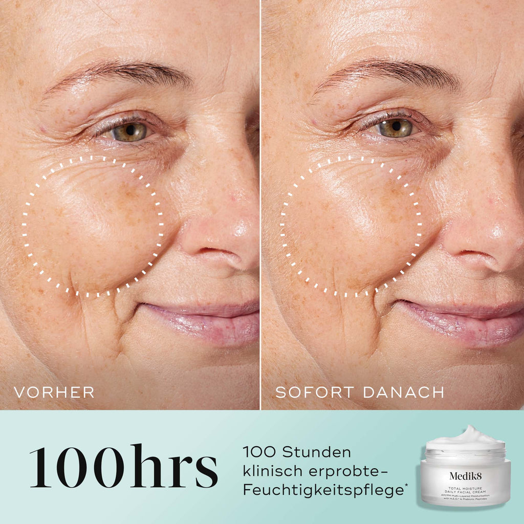 Total Moisture Daily Facial Cream™ (wersja podróżna)