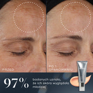 97% – Porównanie zdjęcia czoła uczestniczki przed i po zastosowaniu preparatu Medik8 Crystal Retinal pokazuje wyraźną poprawę stanu skóry po zużyciu jednej tubki. Zgodnie z opisem 97% osób uznało, że ich skóra wyglądała młodziej.