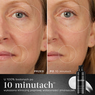 10 minut – Porównanie twarzy uczestniczki przed i po zastosowaniu produktu, przedstawione obok butelki preparatu Medik8 Liquid Peptides Advanced MP. Zdjęcia pokazują zmniejszenie zmarszczek wokół oczu i ust. Tekst podkreśla, że u 100% osób zaobserwowano kliniczną poprawę w zakresie widocznych zmarszczek w ciągu 10 minut.