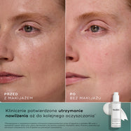 Zdjęcia twarzy kobiety przed i po zabiegu, umieszczone obok siebie, pokazujące poprawę nawilżenia i przejrzystości skóry, wraz z informacją o produkcie i tekstem potwierdzającym jego działanie.